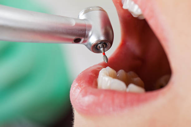 Best Emergency Dental Care for Broken or Chipped Teeth in Hamshire, TX
